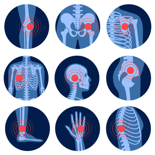 Musculoskeletal Physiotherapy